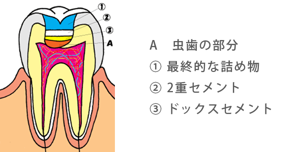ドックスベスト ドックスベスト